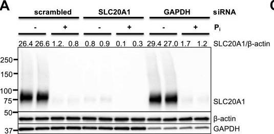 Fig.1.A showing Western Blotting in a Homo sapiens (Human) sample from the publication: Cellular abundance of sodium phosphate cotransporter SLC20A1/PiT1 and phosphate uptake are controlled post-transcriptionally by ESCRT.