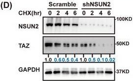 Fig.6.D showing Western Blotting from the publication: NSUN2 promotes colorectal cancer progression by enhancing SKIL mRNA stabilization.