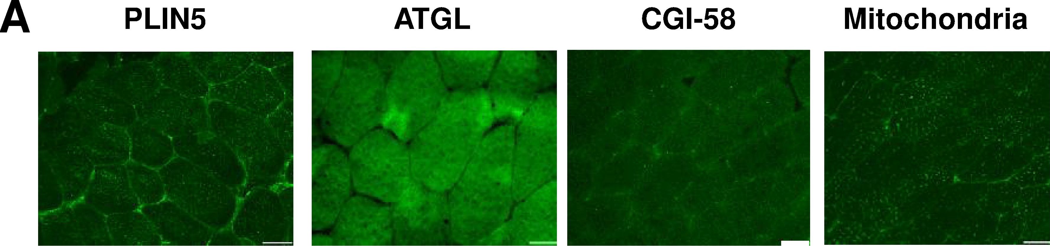 Cellular localization and associations of the major lipolytic proteins in human skeletal muscle at rest and during exercise.