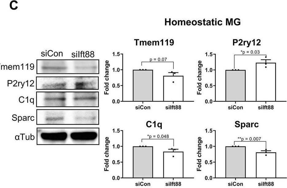 Fig.4.C showing Western Blotting in a Mus musculus (House mouse) sample from the publication: Primary cilia-mediated regulation of microglial secretion in Alzheimer's disease.