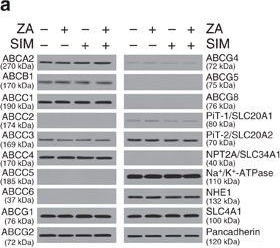 Fig.3.A showing Western Blotting in a Homo sapiens (Human) sample from the publication: The ATP-binding cassette transporter A1 regulates phosphoantigen release and Vγ9Vδ2 T cell activation by dendritic cells.