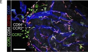 Fig.5.E showing Immunohistochemistry-immunofluorescence in a Mus musculus (House mouse) sample from the publication: CD163+ macrophages monitor enhanced permeability at the blood-dorsal root ganglion barrier.
