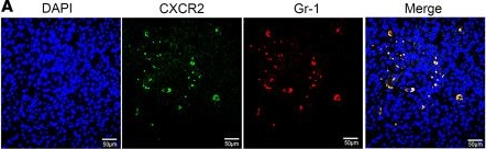 Fig.4.A showing Immunohistochemistry-immunofluorescence in a Mus musculus (House mouse) sample from the publication: Gut microbial metabolite 4-hydroxybenzeneacetic acid drives colorectal cancer progression via accumulation of immunosuppressive PMN-MDSCs.
