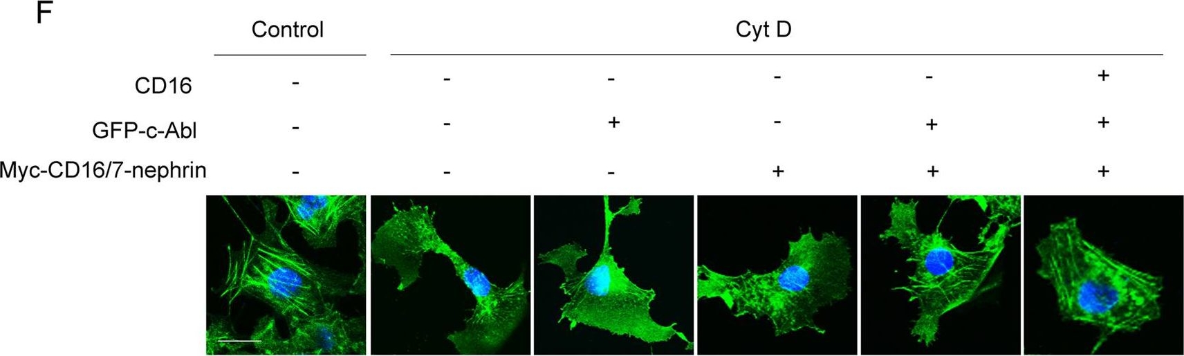 Role of c-Abl and nephrin in podocyte cytoskeletal remodeling induced by angiotensin II.