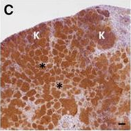 Fig.5.C showing Immunohistochemistry in a Bos taurus (Bovine) sample from the publication: The C3HeB/FeJ mouse model recapitulates the hallmark of bovine tuberculosis lung lesions following Mycobacterium bovis aerogenous infection.