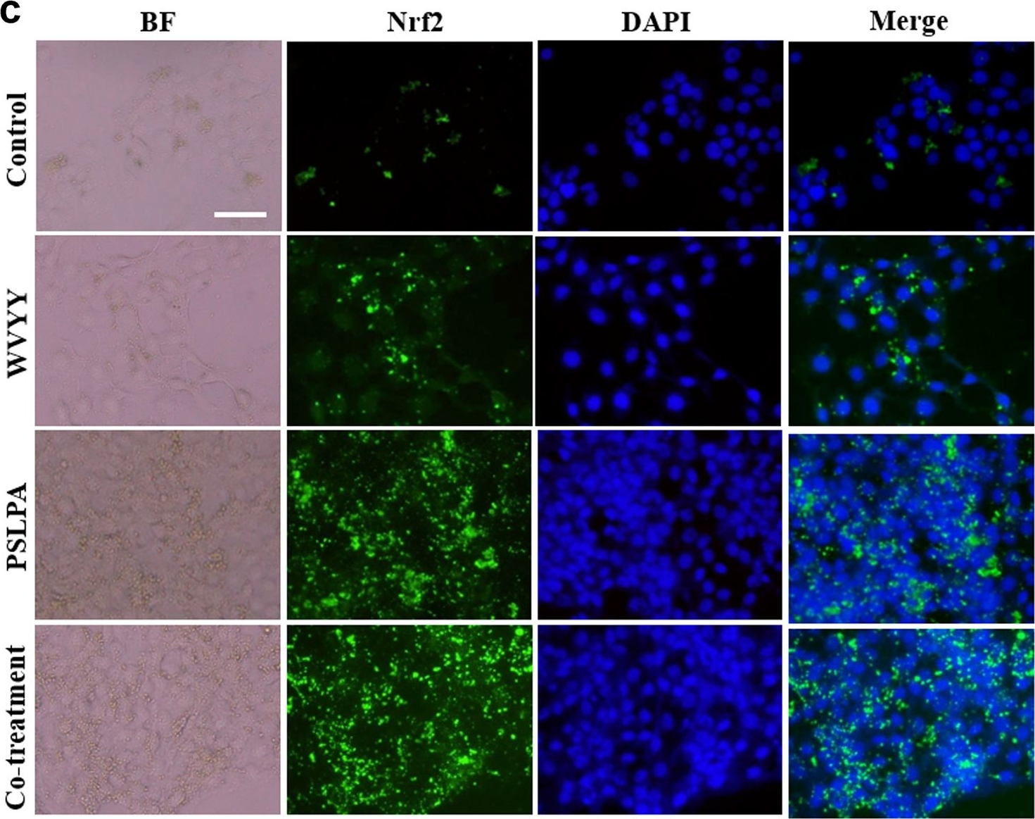 Fig.4.C showing Immunocytochemistry-immunofluorescence in a Homo sapiens (Human) sample from the publication: Cannabis sativa (Hemp) seed-derived peptides WVYY and PSLPA modulate the Nrf2 signaling pathway in human keratinocytes.