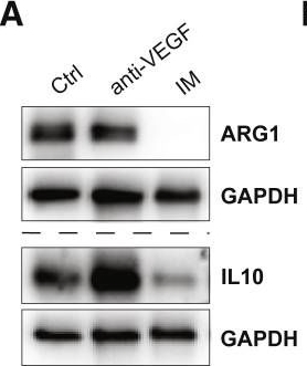Fig.4.A showing Western Blotting in a Mus musculus (House mouse) sample from the publication: Cancer cell autophagy, reprogrammed macrophages, and remodeled vasculature in glioblastoma triggers tumor immunity.