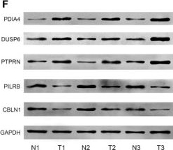 Fig.8.F showing Western Blotting from the publication: Construction and validation of a cuproptosis-related prognostic model for glioblastoma.
