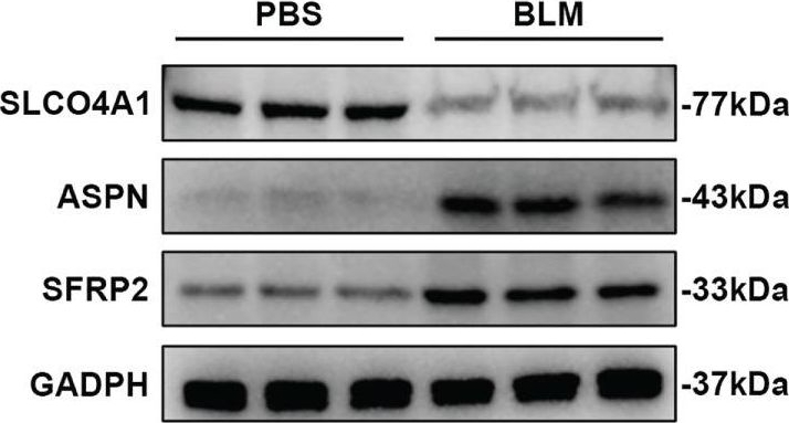 Fig.4.E showing Western Blotting in a Mus musculus (House mouse) sample from the publication: Identification of diagnostic hub genes related to neutrophils and infiltrating immune cell alterations in idiopathic pulmonary fibrosis.