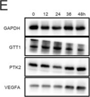 Fig.6.E showing Western Blotting in a Rattus norvegicus (Rat) sample from the publication: Herbal monomer-based therapeutic insights from traditional Chinese medicine in myocardial infarction.