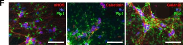 Fig.1.F showing Immunohistochemistry-immunofluorescence in a Mus musculus (House mouse) sample from the publication: Glial Cell Line-derived Neurotrophic Factor and Retinoic Acid Synergy Unlocks Neurogenesis in Adult Myenteric Glia/Neural Progenitors.