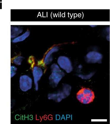 Fig.7.I showing Immunohistochemistry-frozen immunofluorescence in a Mus musculus (House mouse) sample from the publication: Cathelicidins prime platelets to mediate arterial thrombosis and tissue inflammation.