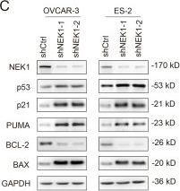Fig.4.C showing Western Blotting from the publication: NEK1 Promotes Ovarian Cancer Progression via p53 Suppression While Enhancing Sensitivity to Genotoxic Therapy.
