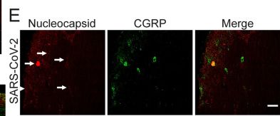 Fig.3.E showing Immunohistochemistry-immunofluorescence from the publication: Intranasal SARS-CoV-2 infection changes the transcriptome of the mouse trigeminal ganglion and brainstem: potential mechanisms underlying headache and trigeminal pain presentation in COVID-19.
