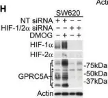 Fig.1.H showing Western Blotting from the publication: Cancer cell adaptation to hypoxia involves a HIF-GPRC5A-YAP axis.