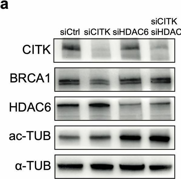 Fig.5.A showing Western Blotting in a Homo sapiens (Human) sample from the publication: CITK modulates BRCA1 recruitment at DNA double strand breaks sites through HDAC6.