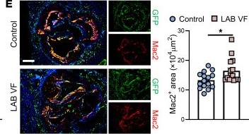 Fig.1.E showing Immunohistochemistry-immunofluorescence from the publication: Inflammatory crosstalk impairs phagocytic receptors and aggravates atherosclerosis in clonal hematopoiesis in mice.