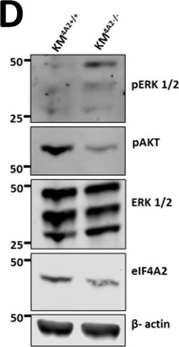 Fig.4.D showing Western Blotting in a Mus musculus (House mouse) sample from the publication: Increased mRNA translation delays tumour initiation and exposes a therapeutic vulnerability in lung cancer.