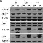 Fig.2.A showing Western Blotting from the publication: Inhibition of HDAC4 Attenuated JNK/c-Jun-Dependent Neuronal Apoptosis and Early Brain Injury Following Subarachnoid Hemorrhage by Transcriptionally Suppressing MKK7.