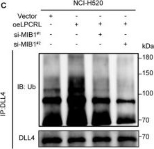 Fig.5.C showing Western Blotting from the publication: A novel antisense lncRNA, LPCRL, functions as a molecular scaffold for the USP15/MIB1 complex to promote primary cisplatin resistance and tumor progression in lung squamous cell carcinoma.