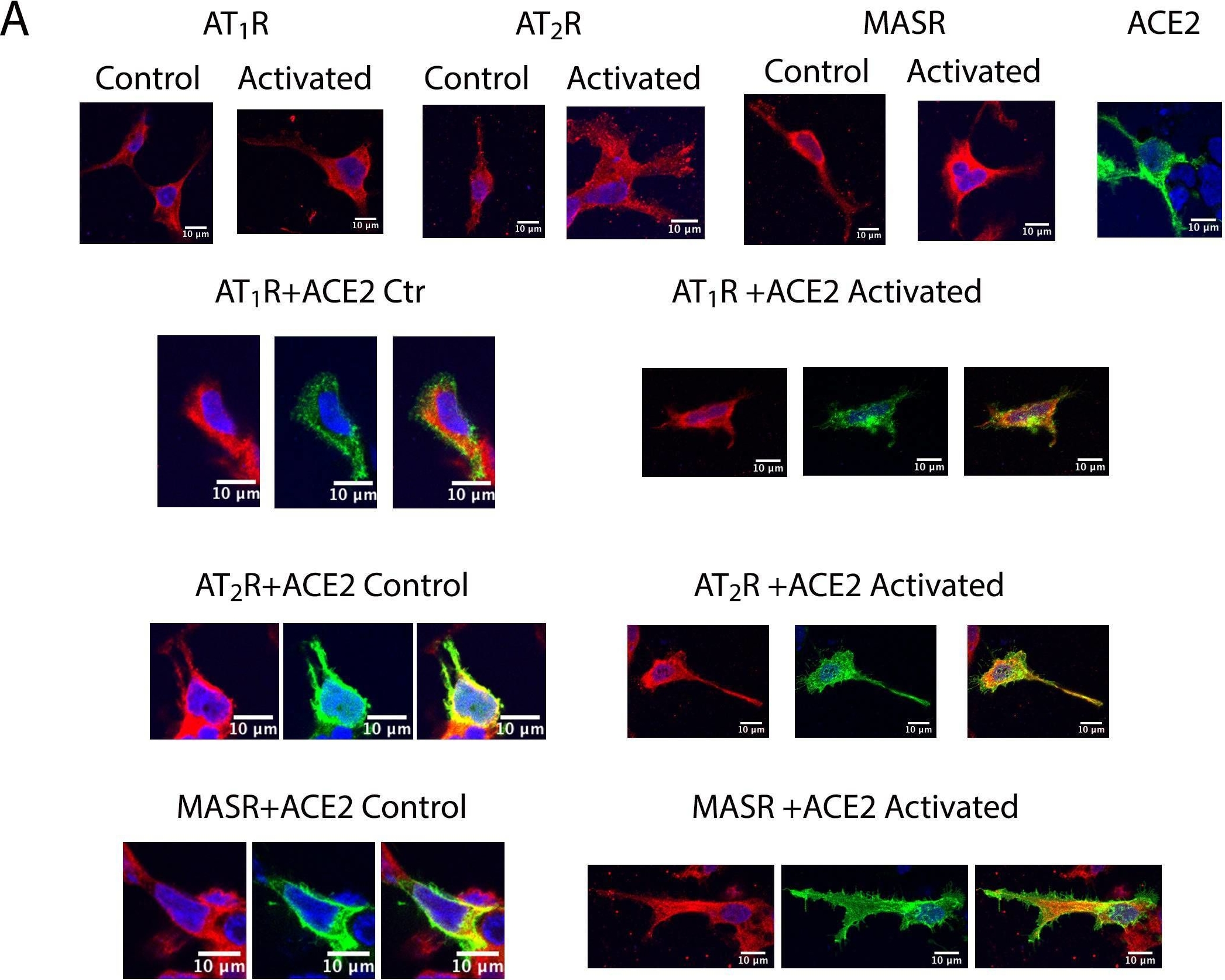 Fig.5.A showing Immunocytochemistry-immunofluorescence in a Homo sapiens (Human) sample from the publication: Functional Complexes of Angiotensin-Converting Enzyme 2 and Renin-Angiotensin System Receptors: Expression in Adult but Not Fetal Lung Tissue.