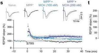 Fig.7.S from the publication: Central Role of Hypothalamic Circuits for Acupuncture's Anti-Parkinsonian Effects.