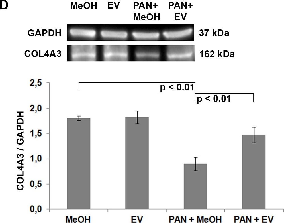 Fig.1.D showing Western Blotting in a Homo sapiens (Human) sample from the publication: Everolimus Stabilizes Podocyte Microtubules via Enhancing TUBB2B and DCDC2 Expression.