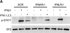 Fig.6.A showing Western Blotting in a Homo sapiens (Human) sample from the publication: Type I and Type III Interferons Display Different Dependency on Mitogen-Activated Protein Kinases to Mount an Antiviral State in the Human Gut.