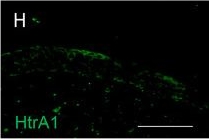 Fig.6.H showing Immunohistochemistry-immunofluorescence in a Homo sapiens (Human) sample from the publication: Contribution of Streptococcus pseudopneumoniae and Streptococcus salivarius to vocal fold mucosal integrity and function.