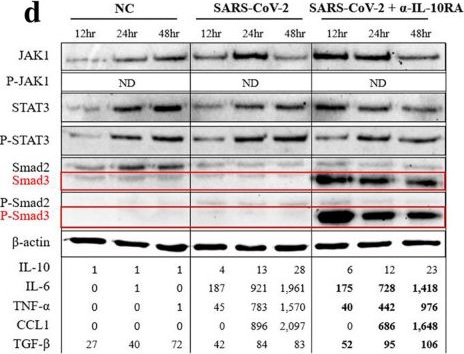 Fig.4.D showing Western Blotting in a Homo sapiens (Human) sample from the publication: Antibodies against interleukin-10 receptor reduce IL-6 and TNF-α levels and increase TGF-β levels in patients with severe fever with thrombocytopenia syndrome virus and SARS-CoV-2 infection.