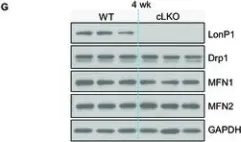 Fig.2.G showing Western Blotting from the publication: LonP1 Links Mitochondria-ER Interaction to Regulate Heart Function.