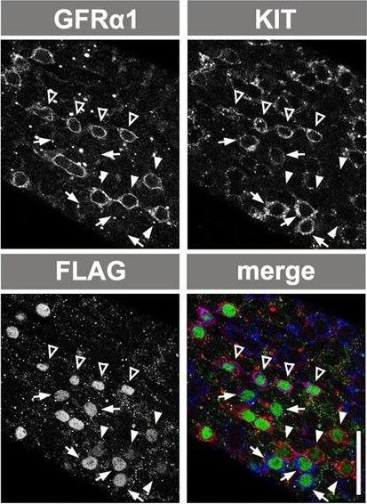 Fig.5.E showing Immunofluorescence in a Mus musculus (House mouse) sample from the publication: Hierarchical differentiation competence in response to retinoic acid ensures stem cell maintenance during mouse spermatogenesis.
