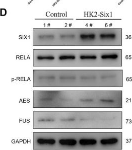 Fig.5.D showing Western Blotting from the publication: SIX1 Activation Is Involved in Cell Proliferation, Migration, and Anti-inflammation of Acute Ischemia/Reperfusion Injury in Mice.