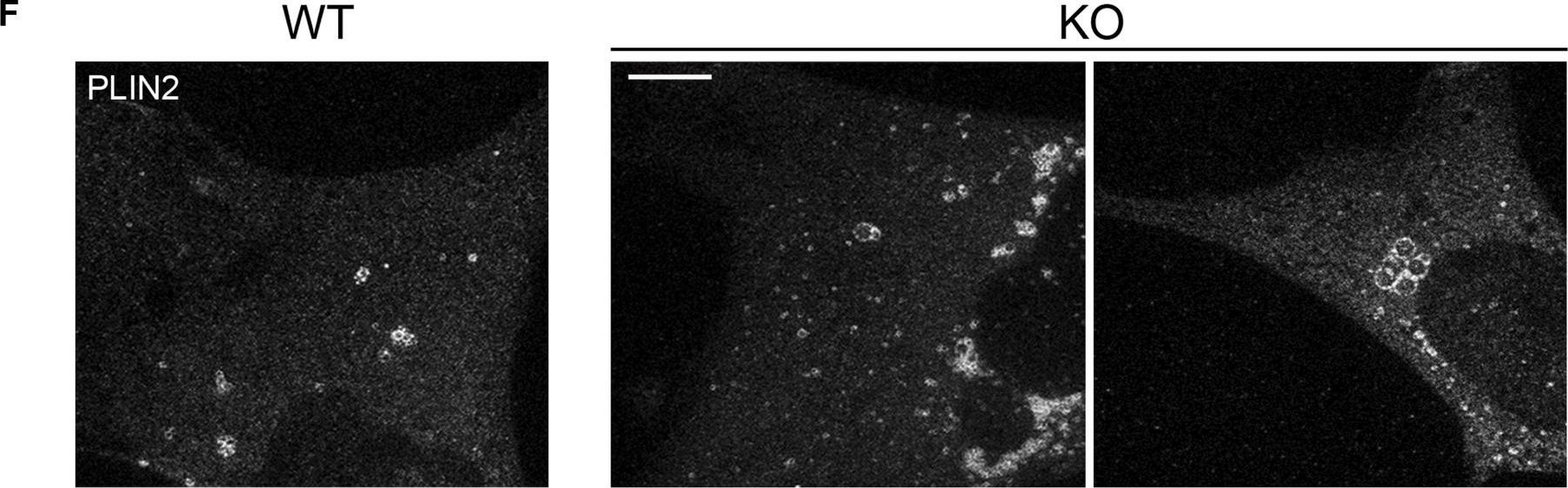 Microtubule-dependent and independent roles of spastin in lipid droplet dispersion and biogenesis.