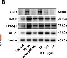 Fig.9.B showing Western Blotting in a Homo sapiens (Human) sample from the publication: Investigating the Effects and Potential Mechanisms of Astragalus Root Against Diabetic Nephropathy Based on Bioinformatics Analysis and In Vitro Validation.