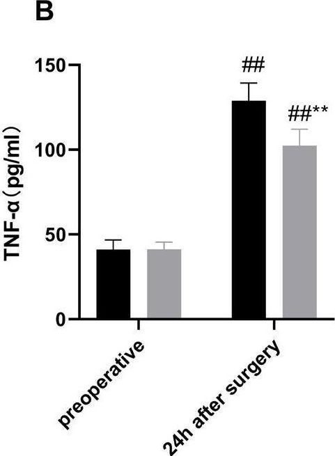 Fig.2.B showing Enzyme-linked immunosorbent assay from the publication: Effect of Ozone Autohemotherapy on Inflammatory Response and Postoperative Cognitive Function in Patients Undergoing Valve Replacement with Cardiopulmonary Bypass.