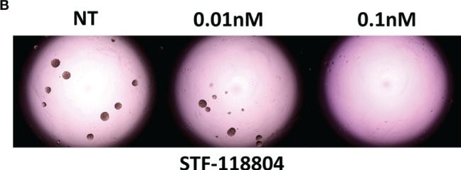 Fig.3.B from the publication: NAMPT Inhibition Induces Neuroblastoma Cell Death and Blocks Tumor Growth.