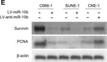 Fig.1.E showing Western Blotting from the publication: Downregulation of miR-10b-3p by EBV promotes tumor growth and metastasis via ITGAV in nasopharyngeal carcinoma.
