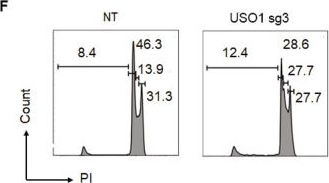 Fig.3.F showing Flow cytometry/Cell sorting from the publication: Focused CRISPR-Cas9 genetic screening reveals USO1 as a vulnerability in B-cell acute lymphoblastic leukemia.