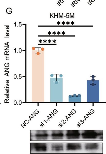 Fig.5.G showing Western Blotting from the publication: DNMT2 inhibits anaplastic thyroid cancer progression by downregulating 5'tiRNAGly-GCC production.