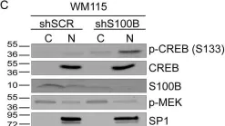 Fig.6.C showing Western Blotting from the publication: The calcium-binding protein S100B reduces IL6 production in malignant melanoma via inhibition of RSK cellular signaling.