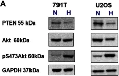 Fig.7.A showing Western Blotting from the publication: Hypoxia-induced cytotoxic drug resistance in osteosarcoma is independent of HIF-1Alpha.