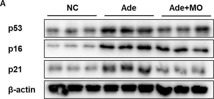 Fig.4.A showing Western Blotting from the publication: Magnolia kobus DC. Alleviates adenine-induced chronic kidney disease by regulating ferroptosis in C57BL/6 mice.