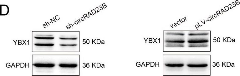 Fig.4.D showing Western Blotting from the publication: CircRAD23B promotes proliferation and carboplatin resistance in ovarian cancer cell lines and organoids.