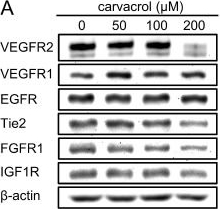 Fig.2.A showing Western Blotting from the publication: The TRPM7 inhibitor carvacrol suppresses angiogenesis and vasculogenic mimicry in triple-negative breast cancer.