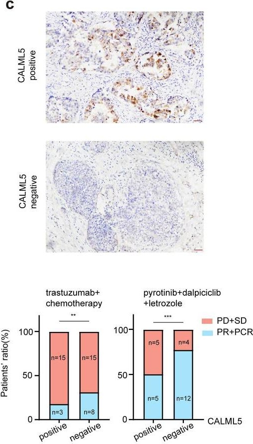 Fig.4.C showing Immunohistochemistry from the publication: Dalpiciclib partially abrogates ER signaling activation induced by pyrotinib in HER2+HR+ breast cancer.