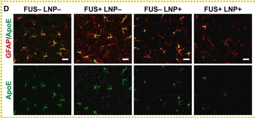 Fig.2.D showing Immunohistochemistry-immunofluorescence in a Mus musculus (House mouse) sample from the publication: Focused ultrasound-mediated lipid nanoparticle delivery for brain gene editing.