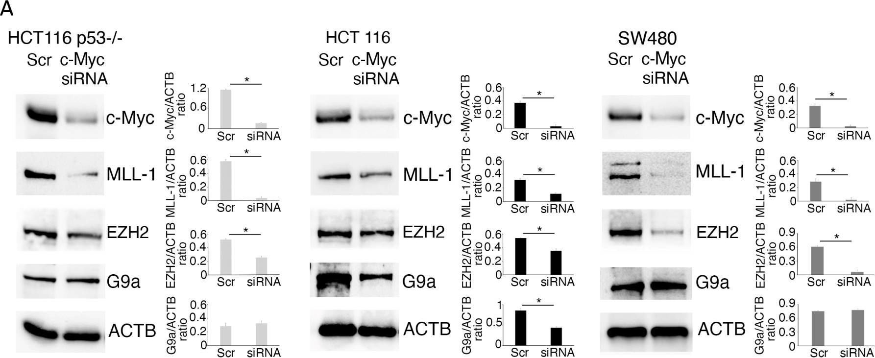 Fig.7.A showing Western Blotting in a Homo sapiens (Human) sample from the publication: Modulatory Effect of Curcumin on Expression of Methyltransferase/Demethylase in Colon Cancer Cells: Impact on wt p53, mutp53 and c-Myc.