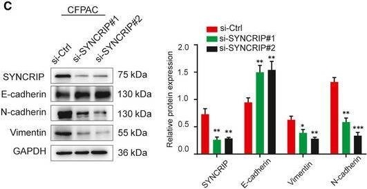 Fig.8.C showing Western Blotting in a Homo sapiens (Human) sample from the publication: A novel antisense lncRNA NT5E promotes progression by modulating the expression of SYNCRIP and predicts a poor prognosis in pancreatic cancer.