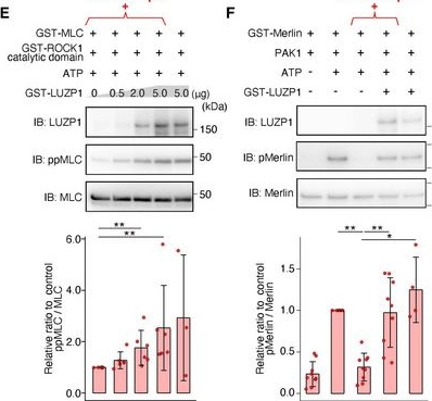 Fig.5.E showing Western Blotting from the publication: A microtubule-LUZP1 association around tight junction promotes epithelial cell apical constriction.